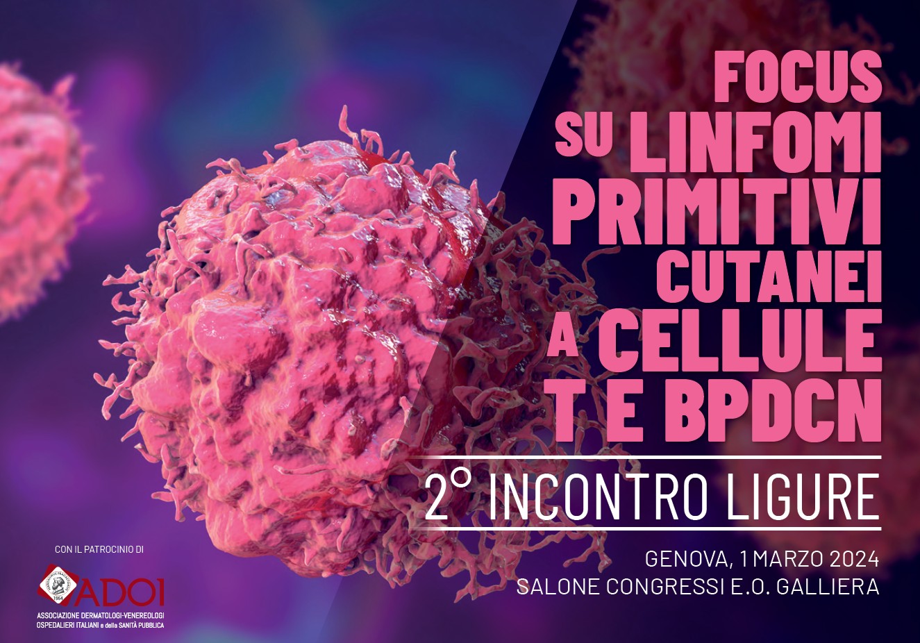 Focus linfomi