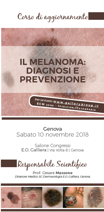 Melanoma